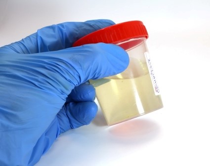 Synthetic Urine Whizzinator Herpoco Hercules CA